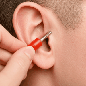 Auricular Therapy