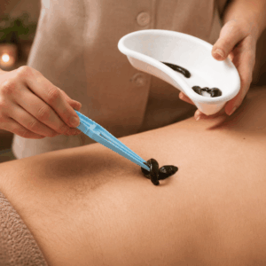Leech Therapy